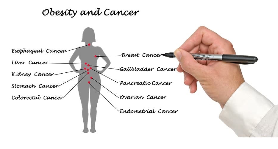 Obesity and cancer: How deleterious is the relationship?