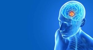 risk-factors-for-brain-cancer-admac
