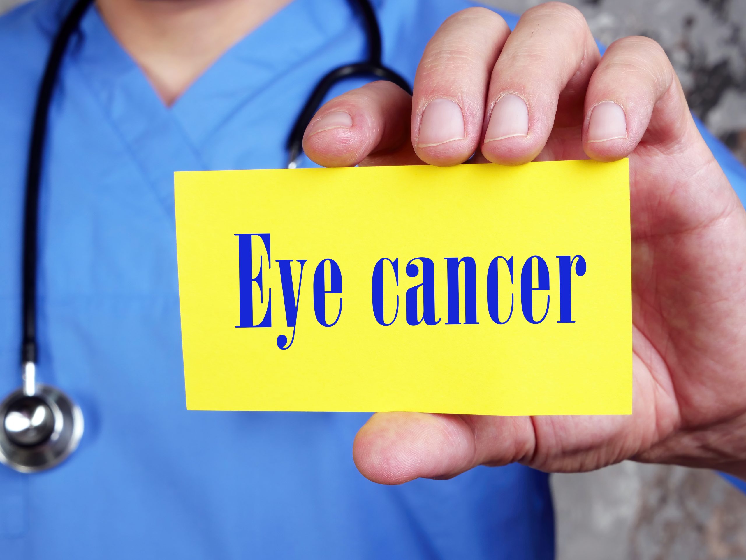 Eye Cancer: What you need to know?